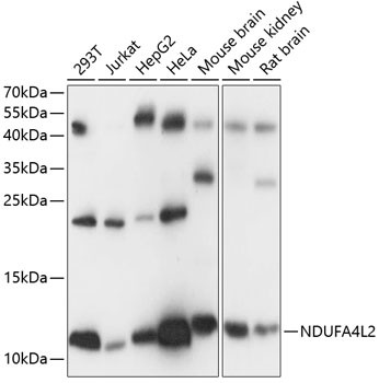 NDUFA4L2 Antibody in Western Blot (WB)