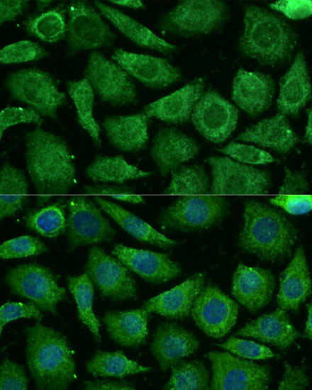 NDUFB3 Antibody in Immunocytochemistry (ICC/IF)