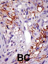 USP22 Antibody in Immunohistochemistry (Paraffin) (IHC (P))