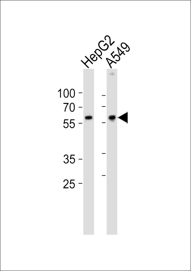 USP22 Antibody in Western Blot (WB)