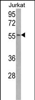 USP22 Antibody in Western Blot (WB)