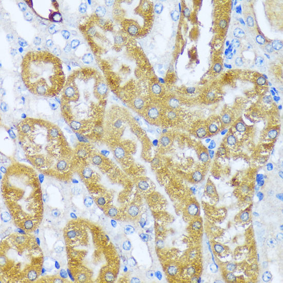 ACOT2 Antibody in Immunohistochemistry (Paraffin) (IHC (P))