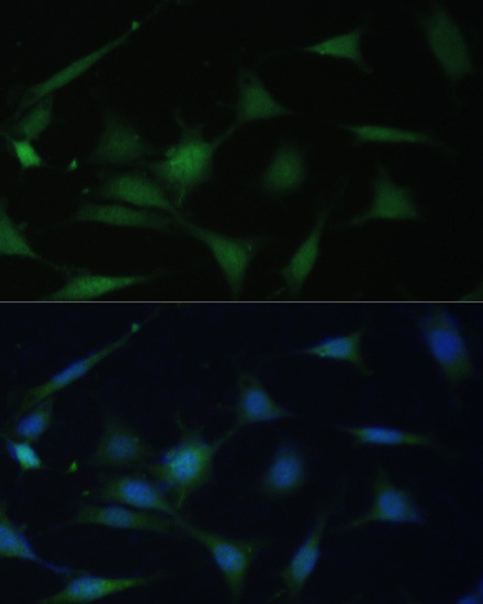 p38 MAPK alpha Antibody in Immunocytochemistry (ICC/IF)