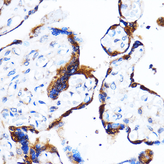 p38 MAPK alpha Antibody in Immunohistochemistry (Paraffin) (IHC (P))