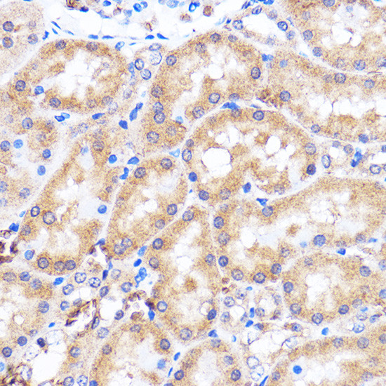 p38 MAPK alpha Antibody in Immunohistochemistry (Paraffin) (IHC (P))