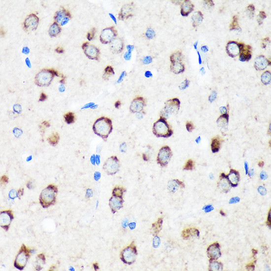 TXNDC12 Antibody in Immunohistochemistry (Paraffin) (IHC (P))