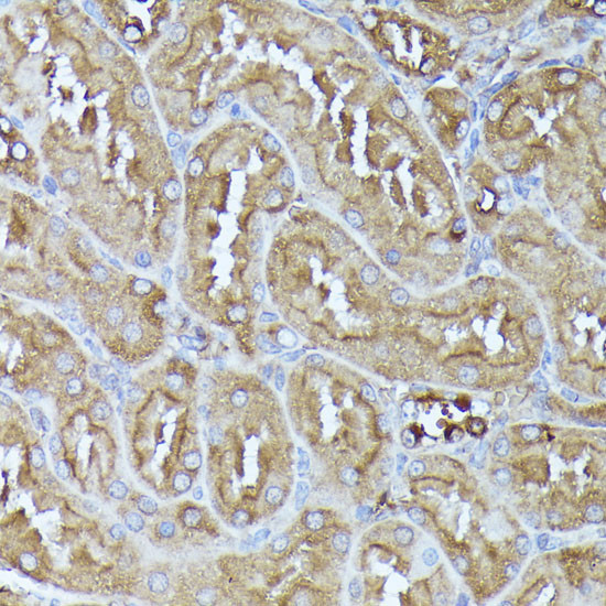 DLAT Antibody in Immunohistochemistry (Paraffin) (IHC (P))