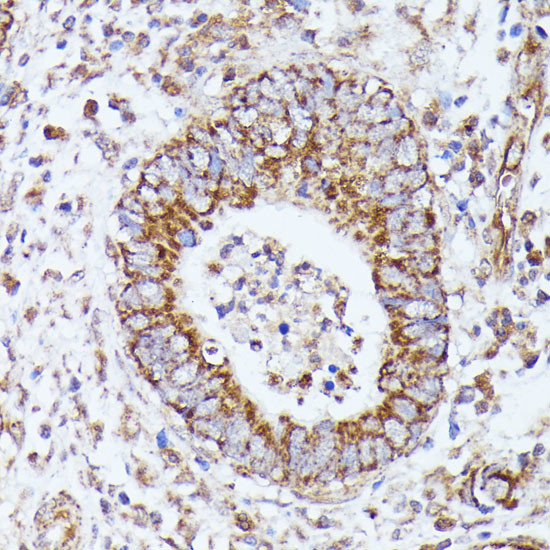 DLAT Antibody in Immunohistochemistry (Paraffin) (IHC (P))