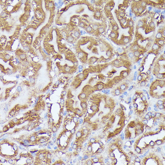 DLAT Antibody in Immunohistochemistry (Paraffin) (IHC (P))