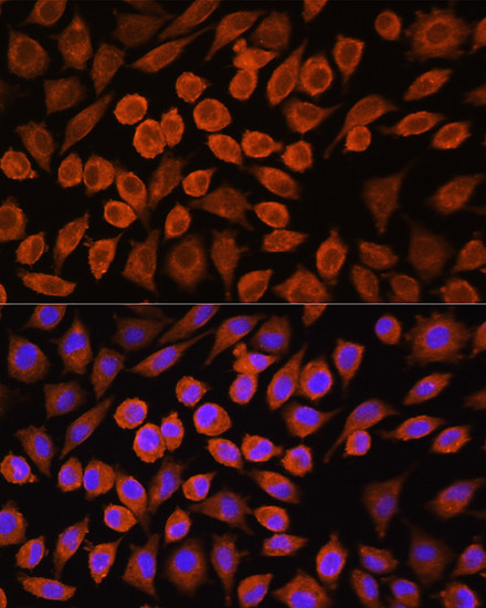 PDP1 Antibody in Immunocytochemistry (ICC/IF)