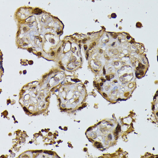 RPS27A Antibody in Immunohistochemistry (Paraffin) (IHC (P))