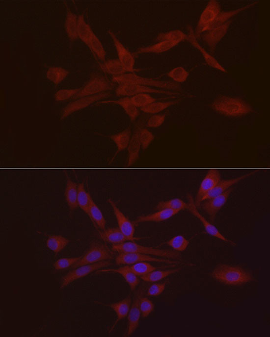 S100A10 Antibody in Immunocytochemistry (ICC/IF)