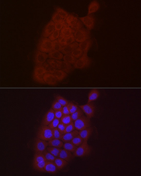 S100A10 Antibody in Immunocytochemistry (ICC/IF)