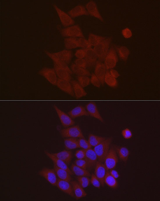 S100A10 Antibody in Immunocytochemistry (ICC/IF)