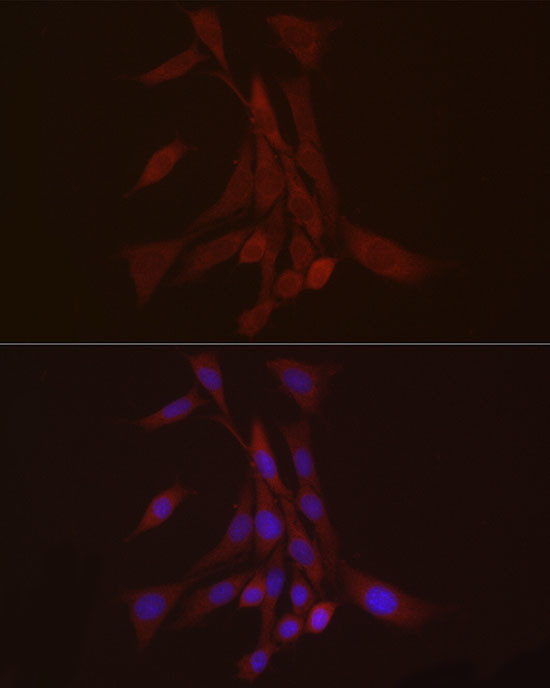 S100A10 Antibody in Immunocytochemistry (ICC/IF)