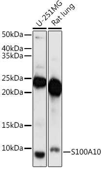 S100A10 Antibody in Western Blot (WB)