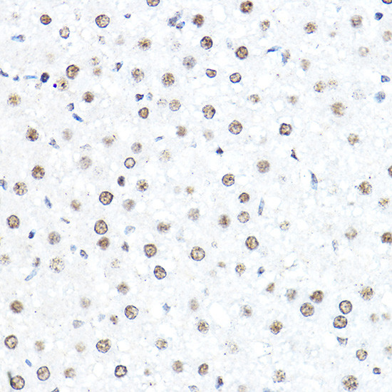 SP1 Antibody in Immunohistochemistry (Paraffin) (IHC (P))