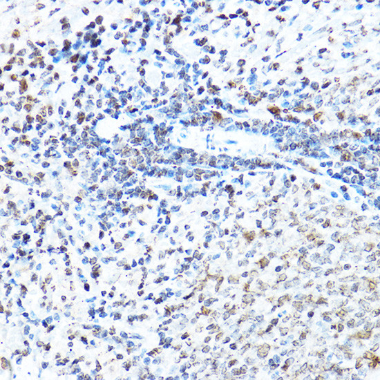 SP1 Antibody in Immunohistochemistry (Paraffin) (IHC (P))