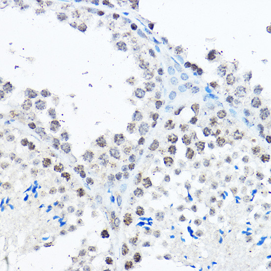 SP1 Antibody in Immunohistochemistry (Paraffin) (IHC (P))