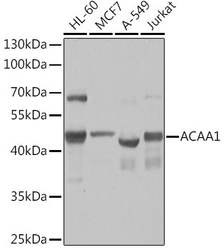 ACAA1 Antibody in Western Blot (WB)