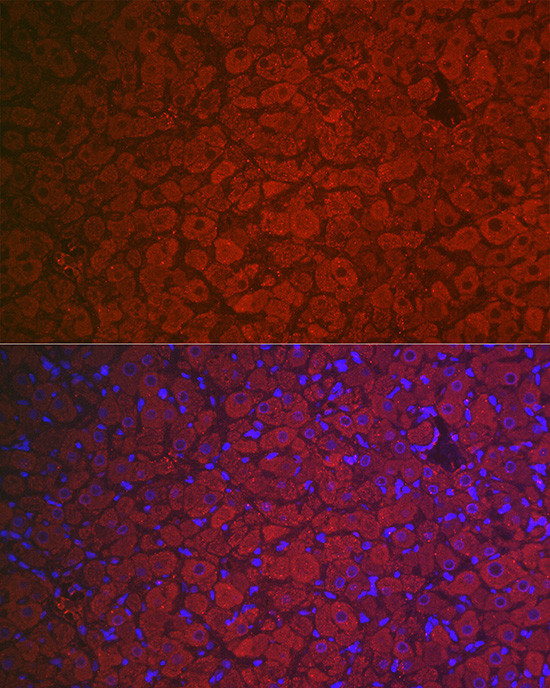 FSHR Antibody in Immunohistochemistry (Paraffin) (IHC (P))