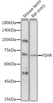 FSHR Antibody in Western Blot (WB)