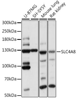 SLC4A8 Antibody in Western Blot (WB)