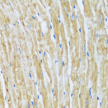 BAG3 Antibody in Immunohistochemistry (Paraffin) (IHC (P))