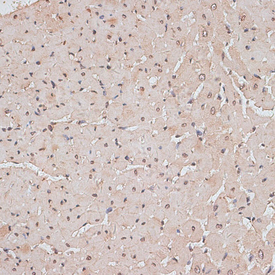 TLK1 Antibody in Immunohistochemistry (Paraffin) (IHC (P))