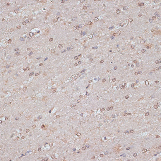 TLK1 Antibody in Immunohistochemistry (Paraffin) (IHC (P))