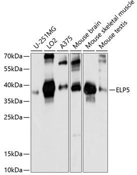 C17orf81 Antibody in Western Blot (WB)