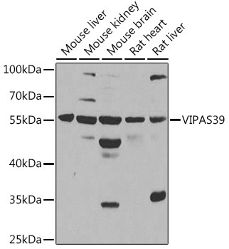 VIPAS39 Antibody in Western Blot (WB)