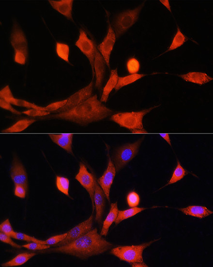 Adenosine Kinase Antibody in Immunocytochemistry (ICC/IF)