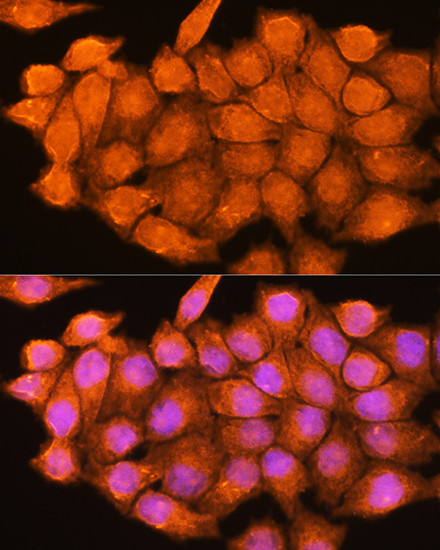 Adenosine Kinase Antibody in Immunocytochemistry (ICC/IF)