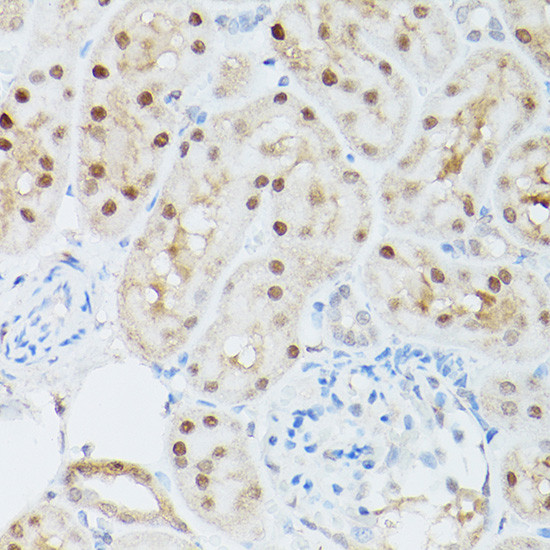 Adenosine Kinase Antibody in Immunohistochemistry (Paraffin) (IHC (P))