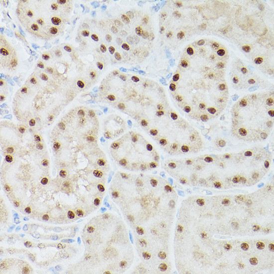 Adenosine Kinase Antibody in Immunohistochemistry (Paraffin) (IHC (P))