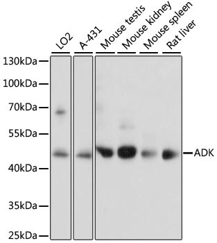 Adenosine Kinase Antibody in Western Blot (WB)