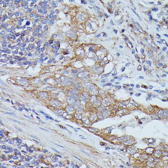 Cortactin Antibody in Immunohistochemistry (Paraffin) (IHC (P))