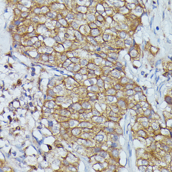 Cortactin Antibody in Immunohistochemistry (Paraffin) (IHC (P))