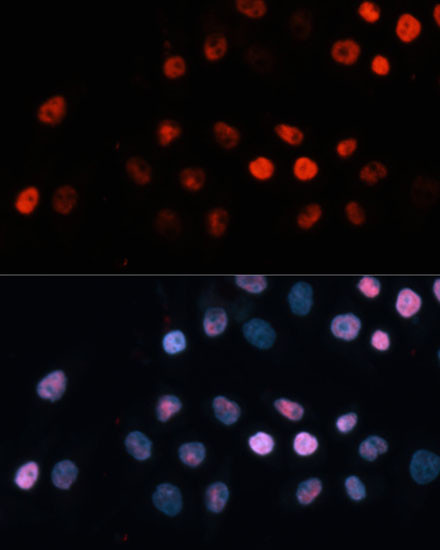 TET1 Antibody in Immunocytochemistry (ICC/IF)