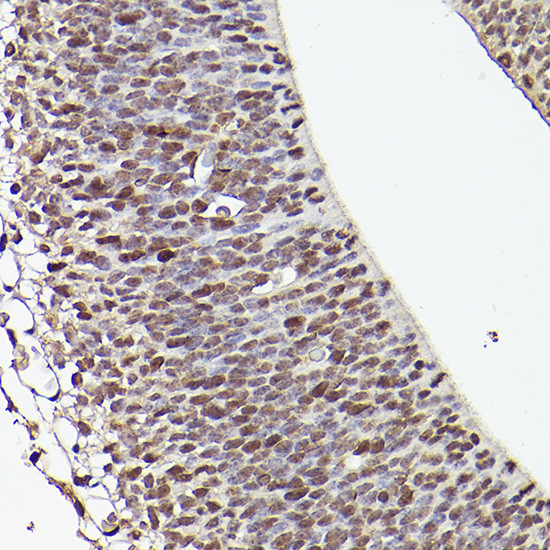 TET1 Antibody in Immunohistochemistry (Paraffin) (IHC (P))