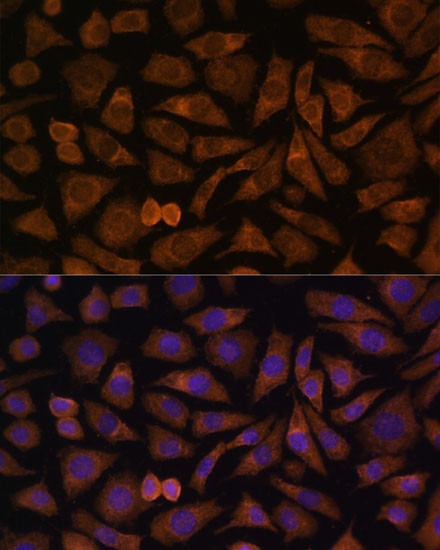 RABIF Antibody in Immunocytochemistry (ICC/IF)