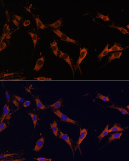 KSR1 Antibody in Immunocytochemistry (ICC/IF)