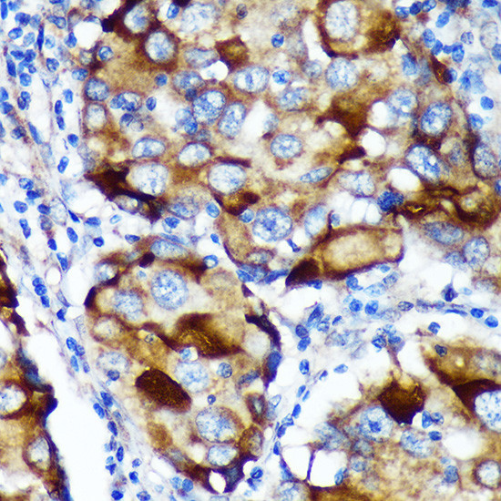 ABCF3 Antibody in Immunohistochemistry (Paraffin) (IHC (P))