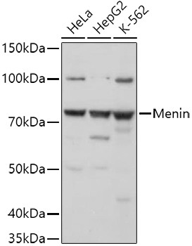 Menin Antibody in Western Blot (WB)