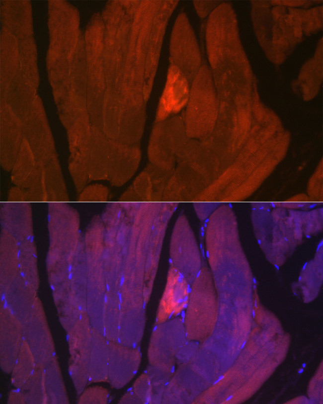 MYH2 Antibody in Immunocytochemistry (ICC/IF)