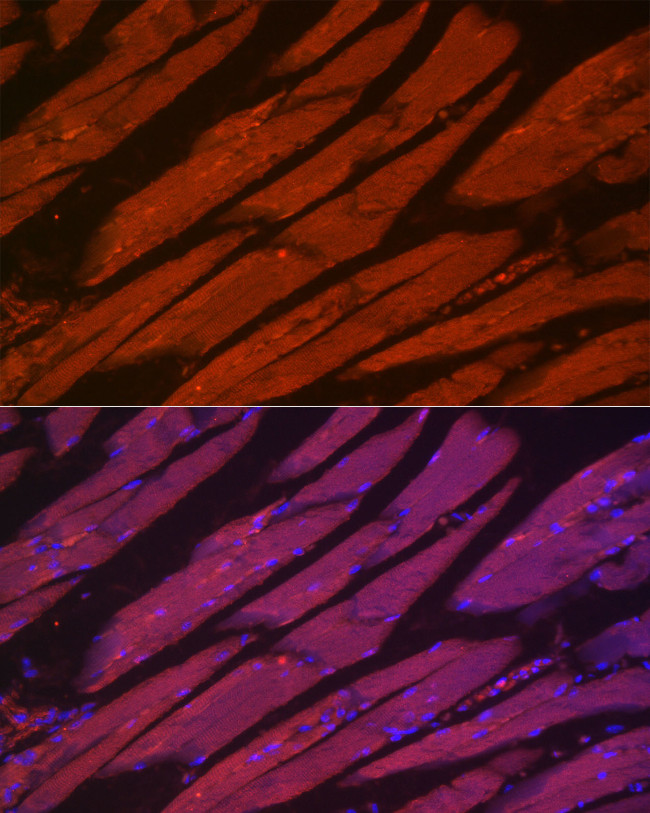 MYH2 Antibody in Immunocytochemistry (ICC/IF)