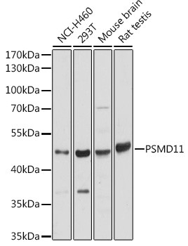 PSMD11 Antibody in Western Blot (WB)