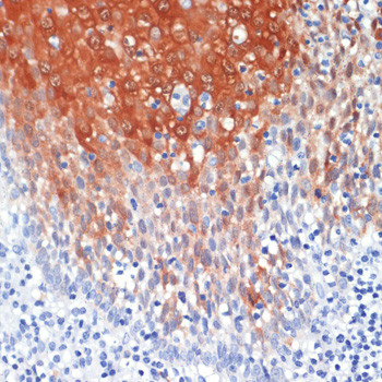 S100A8 Antibody in Immunohistochemistry (Paraffin) (IHC (P))