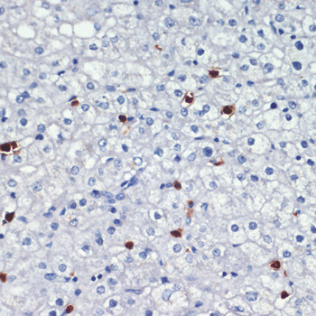 S100A8 Antibody in Immunohistochemistry (Paraffin) (IHC (P))